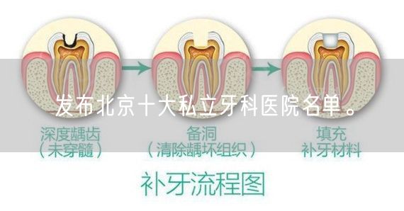 发布北京十大私立牙科医院名单。