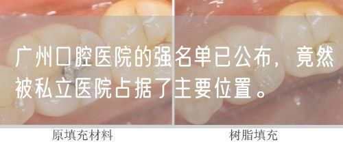 广州口腔医院的强名单已公布，竟然被私立医院占据了主要位置。