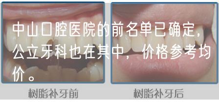 中山口腔医院的前名单已确定，公立牙科也在其中，价格参考均价。