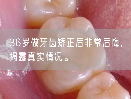 36岁做牙齿矫正后非常后悔，揭露真实情况。