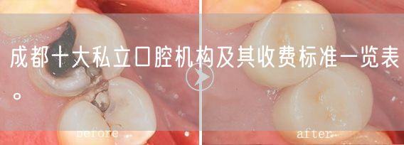 成都十大私立口腔机构及其收费标准一览表。