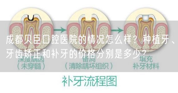 成都贝臣口腔医院的情况怎么样？种植牙、牙齿矫正和补牙的价格分别是多少？