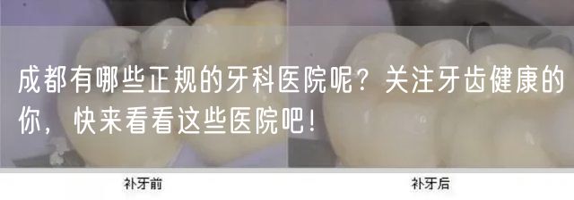 成都有哪些正规的牙科医院呢？关注牙齿健康的你，快来看看这些医院吧！