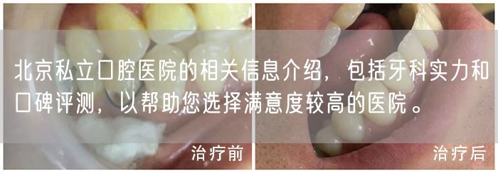 北京私立口腔医院的相关信息介绍，包括牙科实力和口碑评测，以帮助您选择满意度较高的医院。