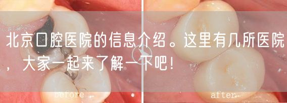 北京口腔医院的信息介绍。这里有几所医院，大家一起来了解一下吧！