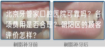 北京牙管家口腔医院可靠吗？各项费用是否合理？朝阳区的顾客评价怎样？