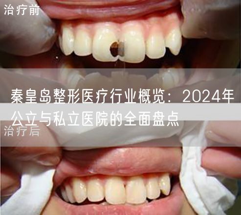 秦皇岛整形医疗行业概览：2024年公立与私立医院的全面盘点