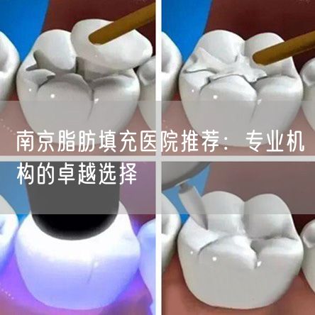 南京脂肪填充医院推荐：专业机构的卓越选择