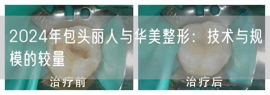 2024年包头丽人与华美整形：技术与规模的较量