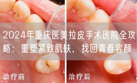 2024年重庆医美拉皮手术医院全攻略：重塑紧致肌肤，找回青春容颜