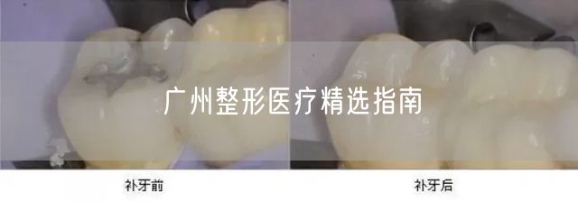 广州整形医疗精选指南
