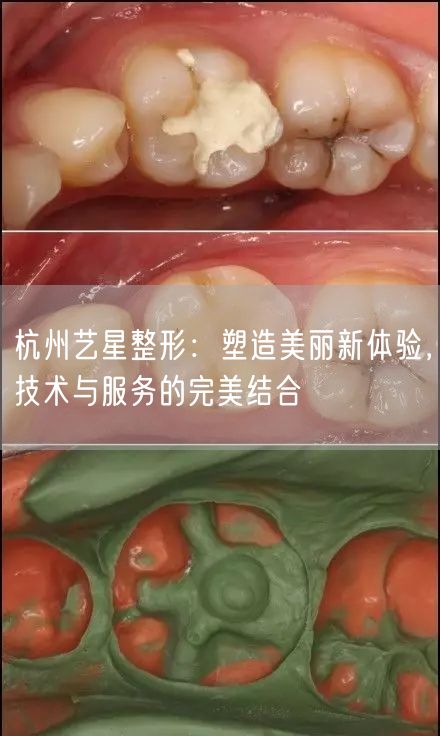 杭州艺星整形：塑造美丽新体验，技术与服务的完美结合