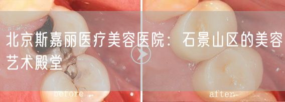 北京斯嘉丽医疗美容医院：石景山区的美容艺术殿堂
