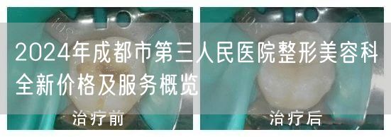 2024年成都市第三人民医院整形美容科全新价格及服务概览