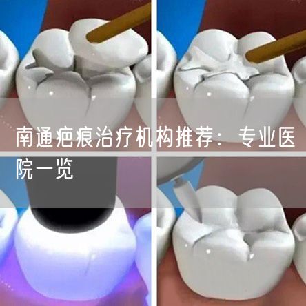 南通疤痕治疗机构推荐：专业医院一览