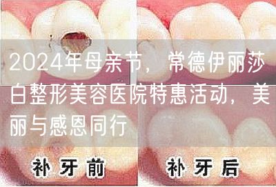 2024年母亲节，常德伊丽莎白整形美容医院特惠活动，美丽与感恩同行