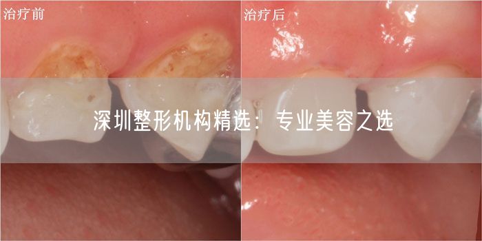 深圳整形机构精选：专业美容之选