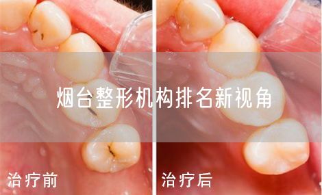 烟台整形机构排名新视角
