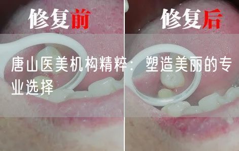 唐山医美机构精粹：塑造美丽的专业选择