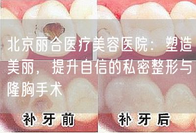 北京丽合医疗美容医院：塑造美丽，提升自信的私密整形与隆胸手术