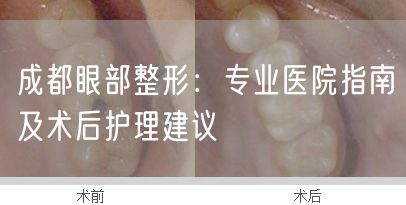 成都眼部整形：专业医院指南及术后护理建议