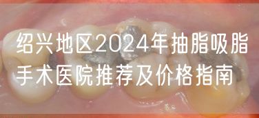 绍兴地区2024年抽脂吸脂手术医院推荐及价格指南
