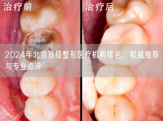 2024年北京顶级整形医疗机构排名：权威推荐与专业点评