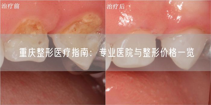 重庆整形医疗指南：专业医院与整形价格一览