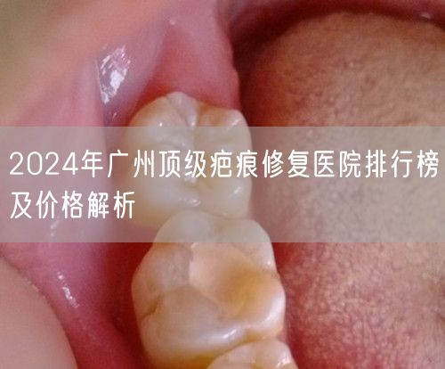 2024年广州顶级疤痕修复医院排行榜及价格解析