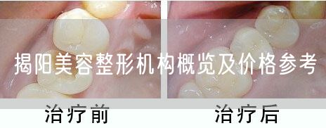 揭阳美容整形机构概览及价格参考