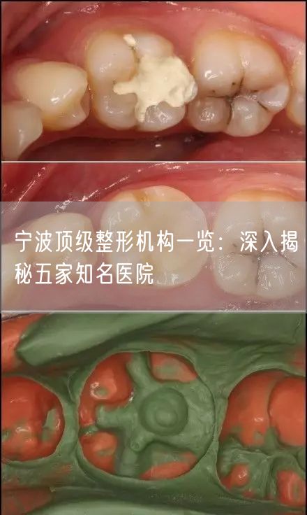 宁波顶级整形机构一览：深入揭秘五家知名医院