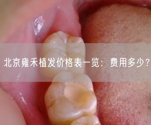北京雍禾植发价格表一览：费用多少？