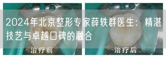 2024年北京整形专家薛轶群医生：精湛技艺与卓越口碑的融合