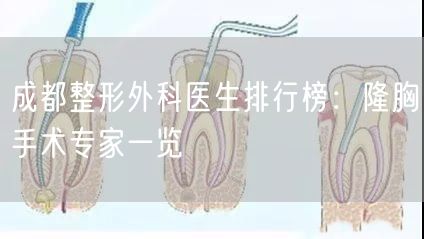 成都整形外科医生排行榜：隆胸手术专家一览