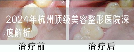 2024年杭州顶级美容整形医院深度解析