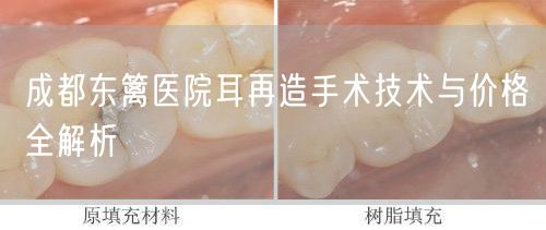 成都东篱医院耳再造手术技术与价格全解析