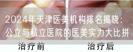 2024年天津医美机构排名揭晓：公立与私立医院的医美实力大比拼