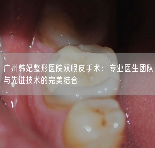 广州韩妃整形医院双眼皮手术：专业医生团队与先进技术的完美结合