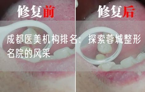 成都医美机构排名：探索蓉城整形名院的风采