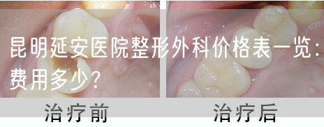昆明延安医院整形外科价格表一览：费用多少？