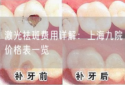 激光祛斑费用详解：上海九院价格表一览