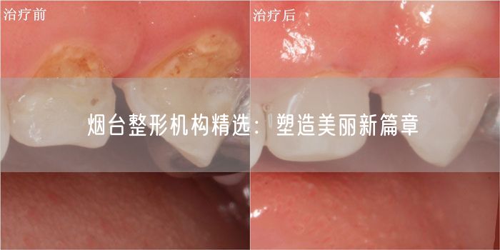 烟台整形机构精选：塑造美丽新篇章