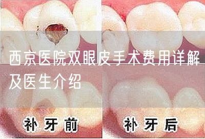 西京医院双眼皮手术费用详解及医生介绍
