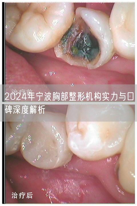 2024年宁波胸部整形机构实力与口碑深度解析