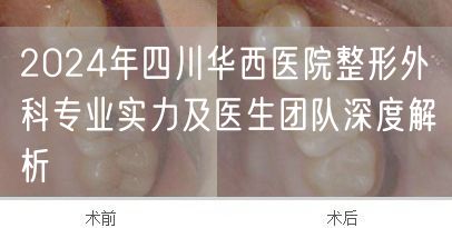 2024年四川华西医院整形外科专业实力及医生团队深度解析
