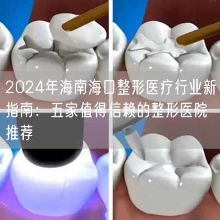 2024年海南海口整形医疗行业新指南：五家值得信赖的整形医院推荐