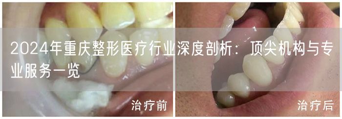 2024年重庆整形医疗行业深度剖析：顶尖机构与专业服务一览