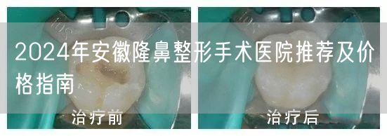 2024年安徽隆鼻整形手术医院推荐及价格指南