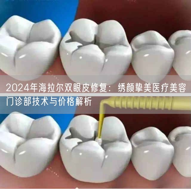 2024年海拉尔双眼皮修复：绣颜挚美医疗美容门诊部技术与价格解析