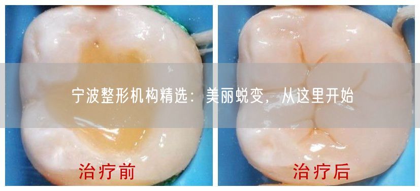 宁波整形机构精选：美丽蜕变，从这里开始